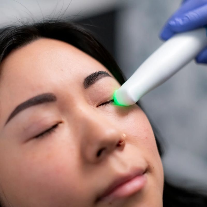 NuLids Pro Treatment at Forest Bluff Optometry